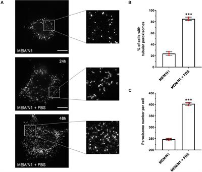 A Functional SMAD2/3 Binding Site in the PEX11β Promoter Identifies a Role for TGFβ in Peroxisome Proliferation in Humans